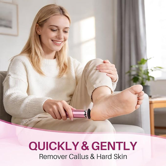 LIONVISON Electric Foot Callus Remover: Adjustable Speed Foot File for Cracked Heels - Working Women&