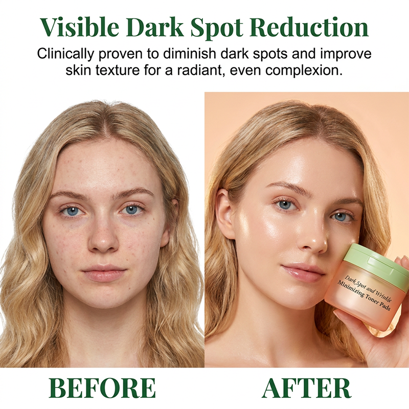 Korean Toner Pads for Wrinkle Reduction, Dark Spot Treatment &amp; Radiant Glow (100 Pads)
