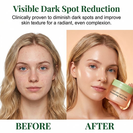 Korean Toner Pads for Wrinkle Reduction, Dark Spot Treatment &amp; Radiant Glow (100 Pads)