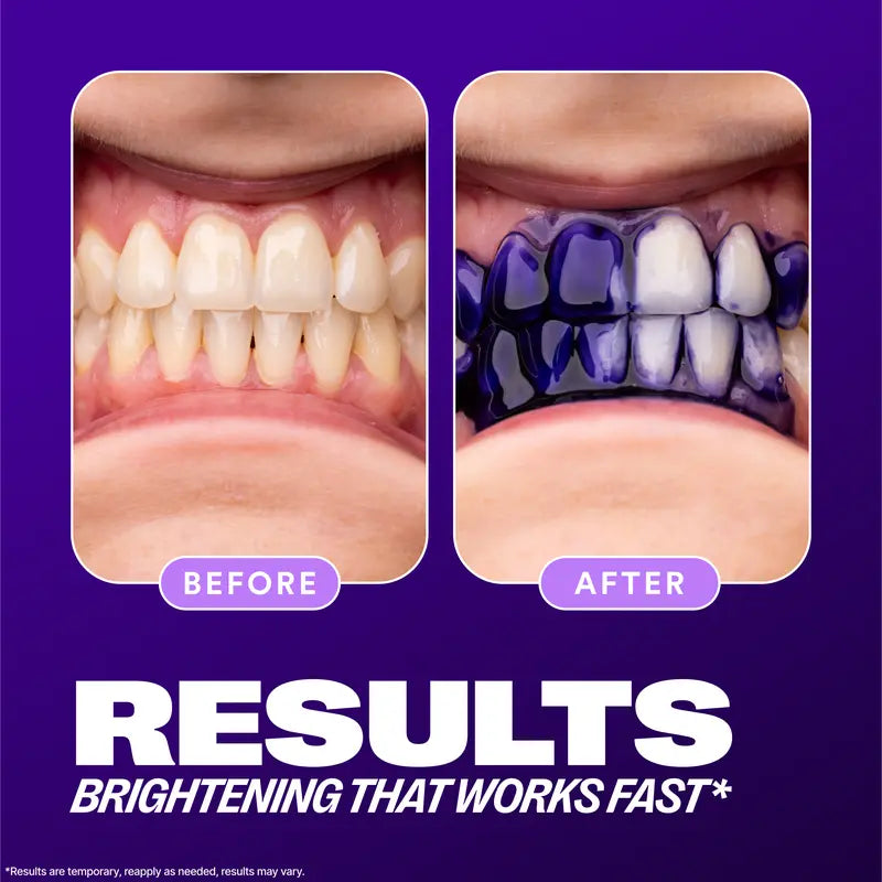 [Recommended by Kim Kardashian] Hismile V34 Colour Corrector - Tooth Stain Concealer, Temporary Brightening Booster, Purple Toothpaste, Colour Correcting