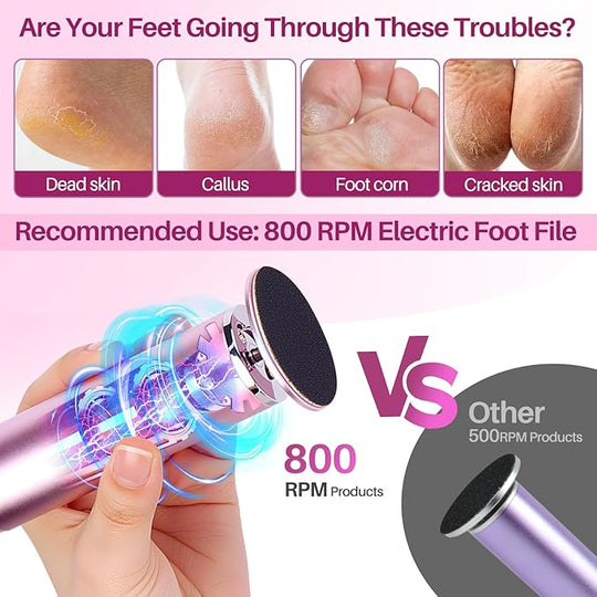 LIONVISON Electric Foot Callus Remover: Adjustable Speed Foot File for Cracked Heels - Working Women&