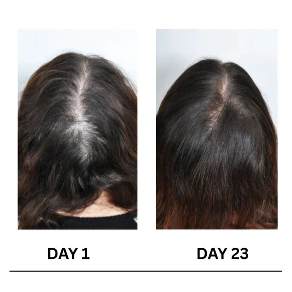 🔥Limited-Time 50% Offer !! 🌿Scalpy Boost+ Hair Growth