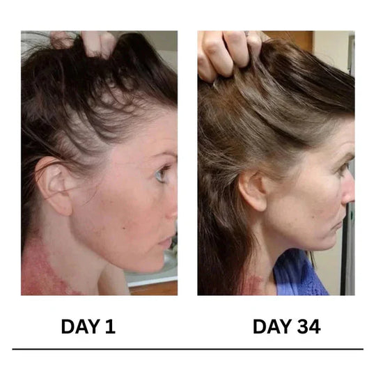 🔥Limited-Time 50% Offer !! 🌿Scalpy Boost+ Hair Growth