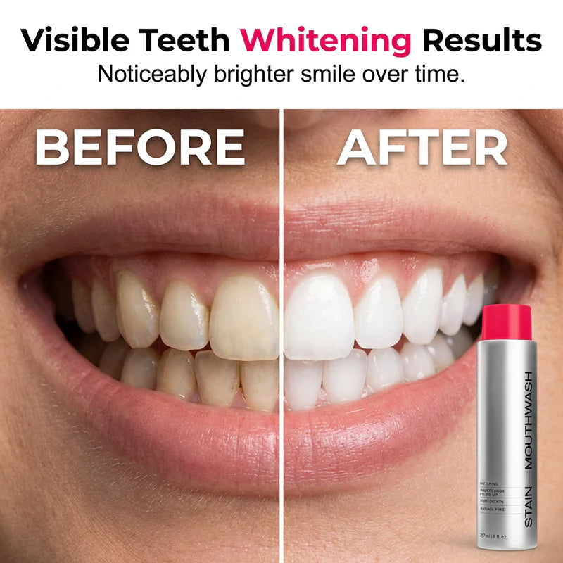 Advanced Stain-Removing Bright Mouthwash
