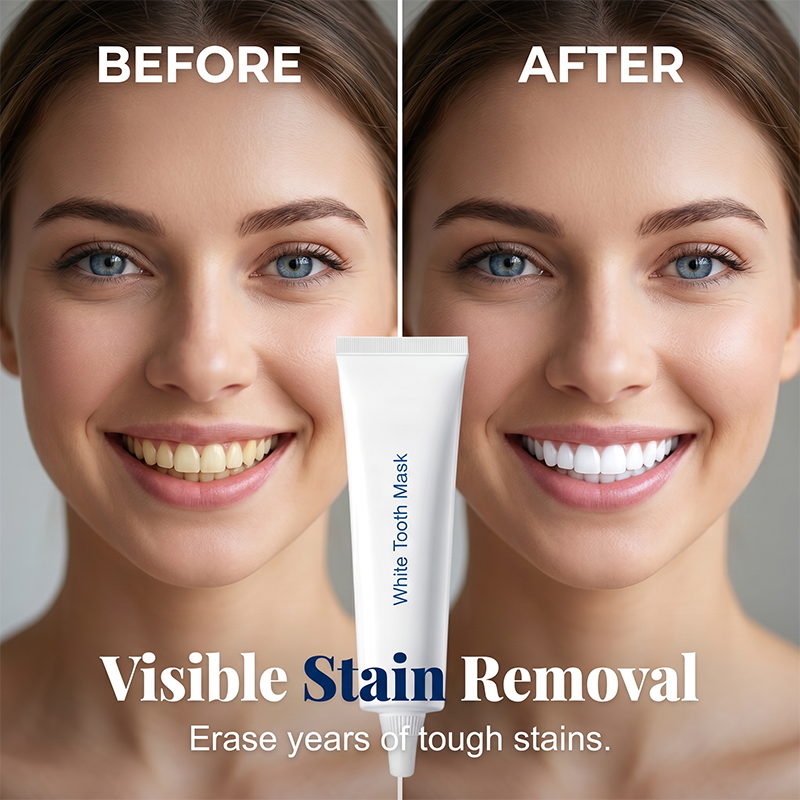 Gentle Teeth Whitening Gel Toothpaste Stain Removal Pen